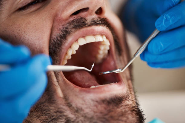 Teeth Whitening in KS